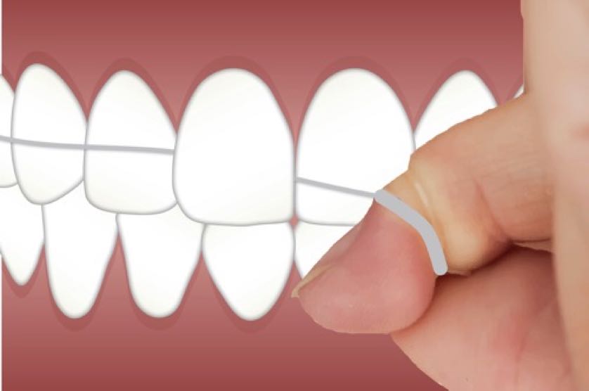 dental-g9faddb76c_1920
